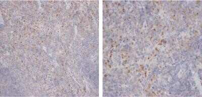 Immunohistochemistry: CD68/SR-D1 Antibody (FA-11) - Azide and BSA Free [NBP2-80656]