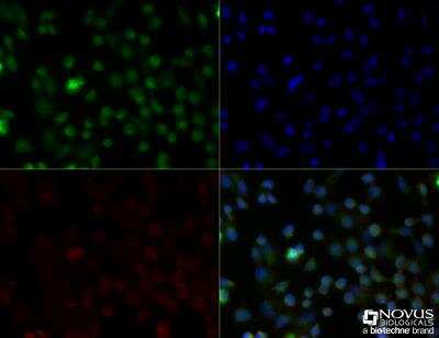 Immunocytochemistry/ Immunofluorescence: CD68/SR-D1 Antibody (FA-11) - BSA Free [NBP2-33337]