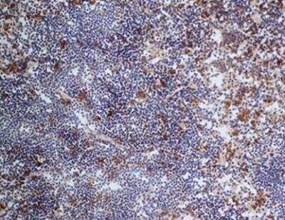 Immunohistochemistry-Paraffin: CD68/SR-D1 Antibody (FA-11) - BSA Free [NBP2-33337]