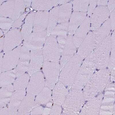 Immunohistochemistry-Paraffin: CD68/SR-D1 Antibody [NBP2-48923]
