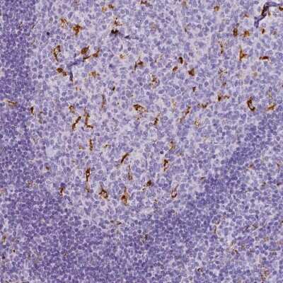Immunohistochemistry-Paraffin: CD68/SR-D1 Antibody [NBP2-48923]