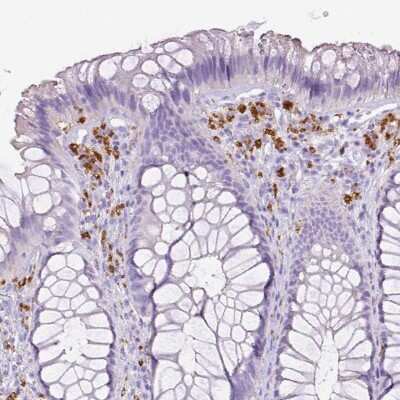 Immunohistochemistry-Paraffin: CD68/SR-D1 Antibody [NBP2-48923]