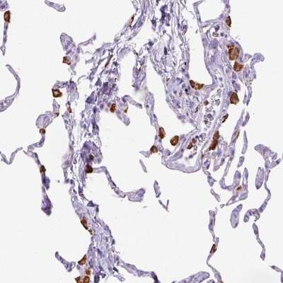 Immunohistochemistry-Paraffin: CD68/SR-D1 Antibody [NBP2-48923]