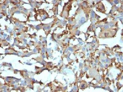 Immunohistochemistry-Paraffin: CD68/SR-D1 Antibody (KP1 + C68/684) - Azide and BSA Free [NBP2-34662]