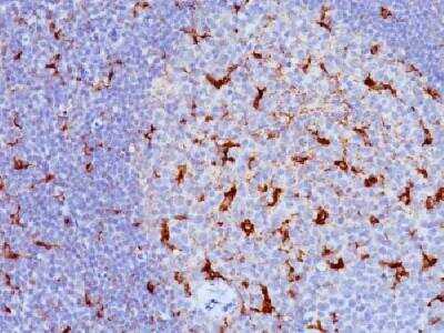 Immunohistochemistry-Paraffin: CD68/SR-D1 Antibody (KP1 + C68/684) - Azide and BSA Free [NBP2-34662]