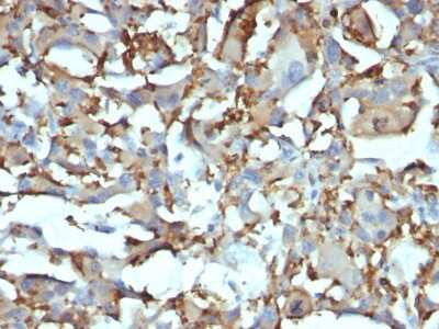 Immunohistochemistry-Paraffin: CD68/SR-D1 Antibody (KP1 + C68/684) [NBP2-34329]