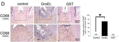 Immunohistochemistry: CD68/SR-D1 Antibody (KP1) - BSA Free [NB100-683]