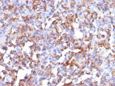 Immunohistochemistry-Paraffin: CD68/SR-D1 Antibody (LAMP4/824) - Azide and BSA Free [NBP2-47902]