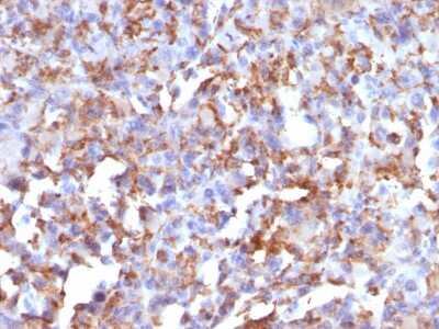 Immunohistochemistry-Paraffin: CD68/SR-D1 Antibody (LAMP4/824) [NBP2-44543]