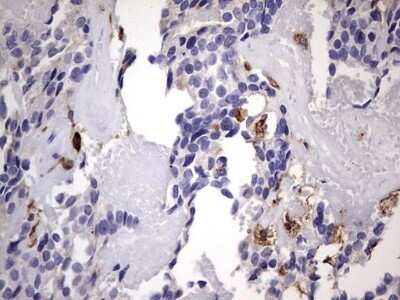 Immunohistochemistry: CD68/SR-D1 Antibody (OTI1E6) - Azide and BSA Free [NBP2-70381]