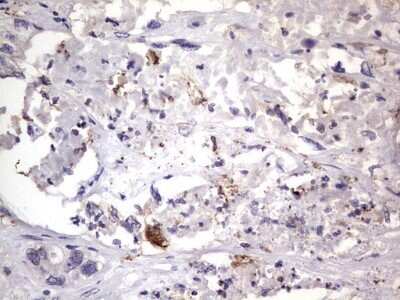 Immunohistochemistry: CD68/SR-D1 Antibody (OTI1E6) - Azide and BSA Free [NBP2-70381]
