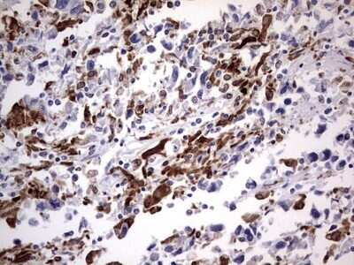 Immunohistochemistry: CD68/SR-D1 Antibody (OTI1E6) - Azide and BSA Free [NBP2-70381]