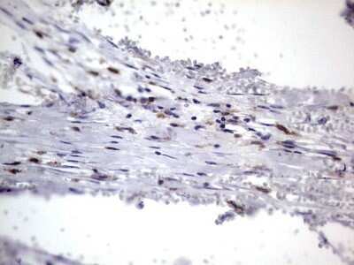 Immunohistochemistry: CD68/SR-D1 Antibody (OTI1E6) - Azide and BSA Free [NBP2-70381]
