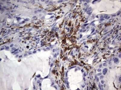 Immunohistochemistry: CD68/SR-D1 Antibody (OTI1E6) - Azide and BSA Free [NBP2-70381]