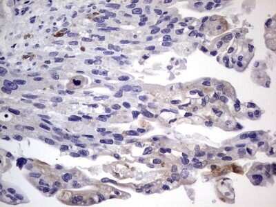 Immunohistochemistry: CD68/SR-D1 Antibody (OTI1E6) - Azide and BSA Free [NBP2-70381]