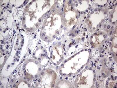 Immunohistochemistry: CD68/SR-D1 Antibody (OTI1E6) - Azide and BSA Free [NBP2-70381]