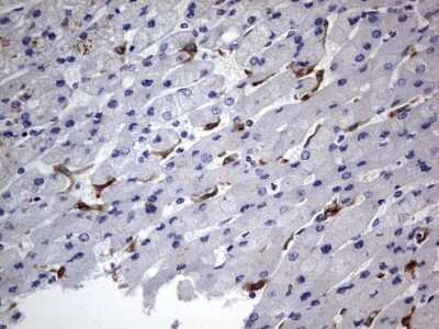 Immunohistochemistry: CD68/SR-D1 Antibody (OTI1E6) - Azide and BSA Free [NBP2-70381]