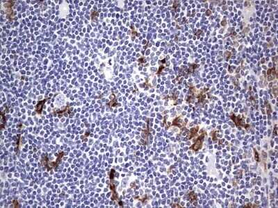 Immunohistochemistry: CD68/SR-D1 Antibody (OTI1E6) - Azide and BSA Free [NBP2-70381]