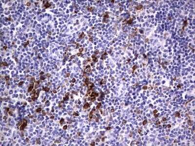 Immunohistochemistry: CD68/SR-D1 Antibody (OTI1E6) - Azide and BSA Free [NBP2-70381]