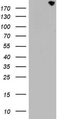 Western Blot: CD68/SR-D1 Antibody (OTI1E6)Azide and BSA Free [NBP2-70381]