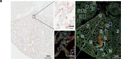 Immunohistochemistry: CD68/SR-D1 Antibody (SPM130) - Azide and BSA Free [NBP2-34736]