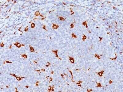 Immunohistochemistry-Paraffin: CD68/SR-D1 Antibody (SPM130) - Azide and BSA Free [NBP2-34736]