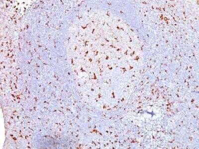 Immunohistochemistry-Paraffin: CD68/SR-D1 Antibody (SPM130) - Azide and BSA Free [NBP2-34736]