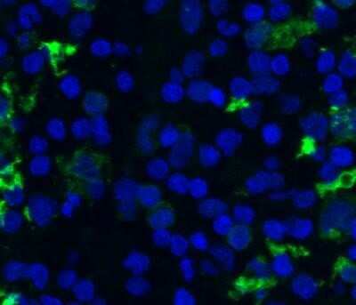 Immunohistochemistry: CD68/SR-D1 Antibody (SPM130) - IHC-Prediluted [NBP2-44540]