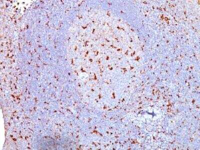 Immunohistochemistry-Paraffin: CD68/SR-D1 Antibody (SPM130) - IHC-Prediluted [NBP2-44540]