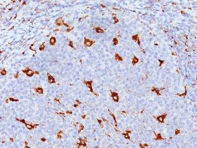 Immunohistochemistry-Paraffin: CD68/SR-D1 Antibody (SPM130) [NBP2-32831]