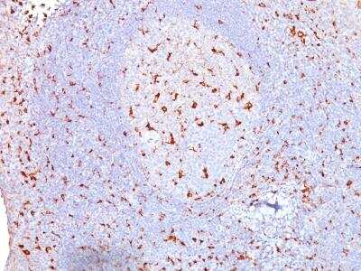 Immunohistochemistry-Paraffin: CD68/SR-D1 Antibody (SPM130) [NBP2-32831]