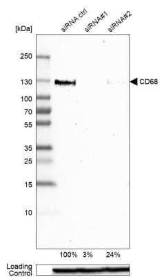 Knockdown Validated: CD68/SR-D1 Antibody [NBP2-48923]