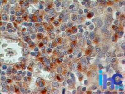 Immunohistochemistry-Paraffin: CD69 Antibody (15B5G2) - Azide Free [NBP2-25242]