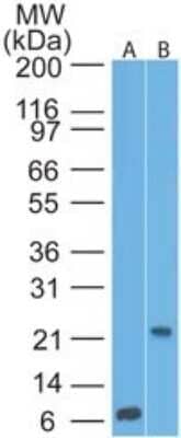 Western Blot: CD69 Antibody (15B5G2)Azide Free [NBP2-25242]