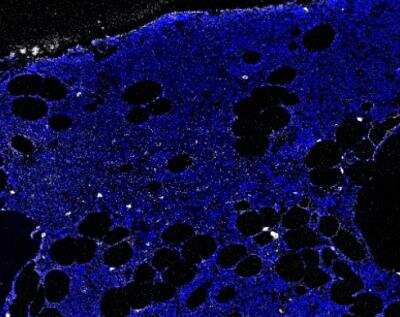 Imaging Mass Cytometry: CD69 Antibody (8B6) - BSA Free [NBP1-51607]