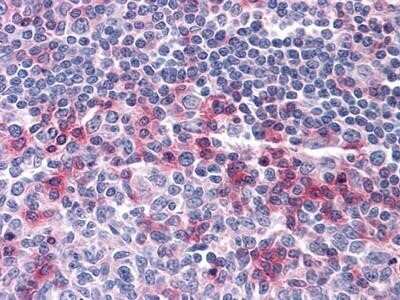 Immunohistochemistry-Paraffin: CD69 Antibody (8B6) - BSA Free [NBP1-51607]