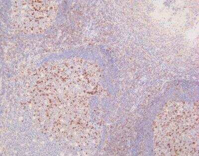 Immunohistochemistry-Paraffin: CD69 Antibody (8B6) - BSA Free [NBP1-51607]