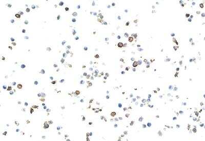 Immunocytochemistry: CD69 Antibody (BLR170J) [NBP3-14744]