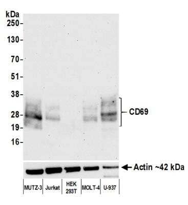 Western Blot: CD69 Antibody (BLR170J) [NBP3-14744]