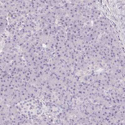 Immunohistochemistry-Paraffin: CD69 Antibody [NBP2-37926]