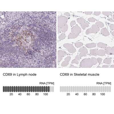 Immunohistochemistry-Paraffin: CD69 Antibody [NBP2-37926]