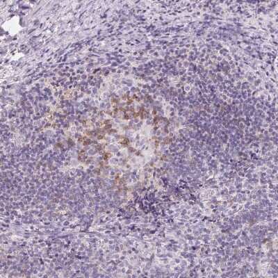 Immunohistochemistry-Paraffin: CD69 Antibody [NBP2-37926]