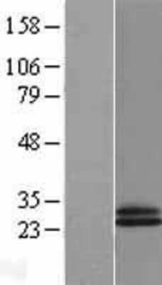 Western Blot: CD69 Overexpression Lysate [NBL1-08963]