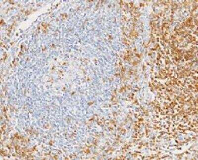 Immunohistochemistry-Paraffin: CD7 Antibody (15) [NBP2-89748]