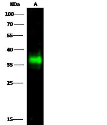 Western Blot: CD7 Antibody (307) [NBP2-89749]