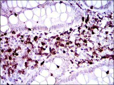 Immunohistochemistry: CD7 Antibody (5B10E3) - BSA Free [NBP2-37368]