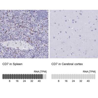 Immunohistochemistry-Paraffin: CD7 Antibody [NBP2-38440]