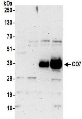 Western Blot: CD7 Antibody [NBP2-32097]