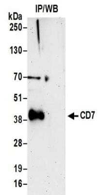 Western Blot: CD7 Antibody [NBP2-32097]