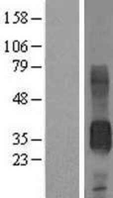 Western Blot: CD7 Overexpression Lysate [NBL1-08964]